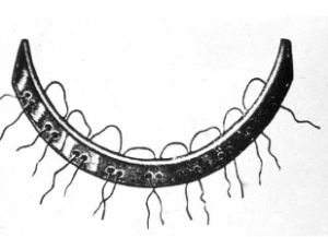Orthodontics timeline Bowling Green KY