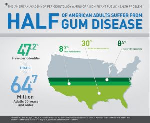 Gum Disease Bowling Green KY